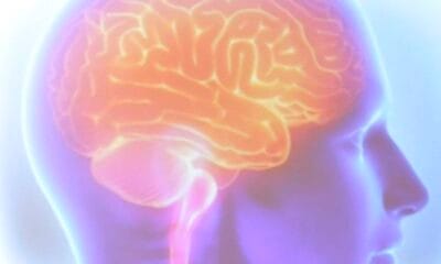 AVC mata uma pessoa a cada seis minutos no Brasil